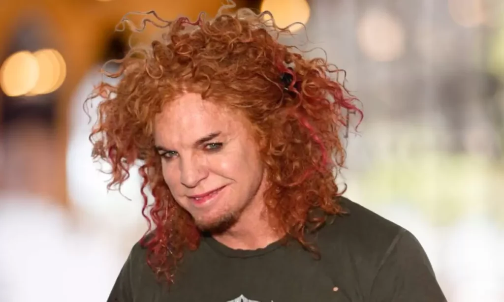 carrot top